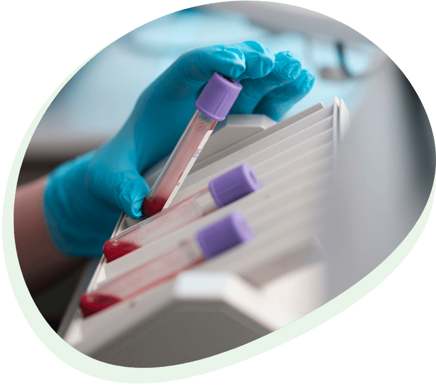 Laboratórna diagnostika